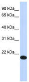 YY1 Associated Factor 2 antibody, TA331108, Origene, Western Blot image 