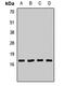 AP2S1 antibody, LS-C667742, Lifespan Biosciences, Western Blot image 