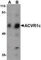 Activin A Receptor Type 1 antibody, PA5-20597, Invitrogen Antibodies, Western Blot image 