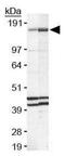 FA Complementation Group D2 antibody, GTX25360, GeneTex, Western Blot image 