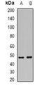 Decapping MRNA 2 antibody, orb341464, Biorbyt, Western Blot image 
