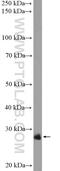 Chromosome 1 Open Reading Frame 216 antibody, 26265-1-AP, Proteintech Group, Western Blot image 