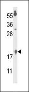 Cytosolic Iron-Sulfur Assembly Component 2B antibody, LS-C165908, Lifespan Biosciences, Western Blot image 