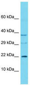 Chromosome 16 Open Reading Frame 90 antibody, TA335925, Origene, Western Blot image 