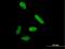 Ribosomal RNA-processing protein 44 antibody, H00022894-B01P, Novus Biologicals, Immunocytochemistry image 