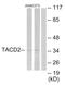 Tumor Associated Calcium Signal Transducer 2 antibody, AP33403PU-N, Origene, Western Blot image 