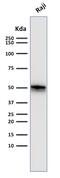 CD79a antibody, GTX34558, GeneTex, Western Blot image 