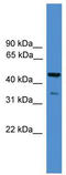TATA-Box Binding Protein Associated Factor 5 Like antibody, TA329434, Origene, Western Blot image 