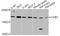 Human Chorionic gonadotrophin antibody, LS-C747699, Lifespan Biosciences, Western Blot image 
