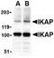 Ikap antibody, TA306056, Origene, Western Blot image 