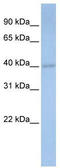Decaprenyl-diphosphate synthase subunit 1 antibody, TA339314, Origene, Western Blot image 