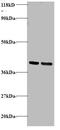 GDP Dissociation Inhibitor 2 antibody, A51496-100, Epigentek, Western Blot image 