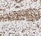 Small Nuclear Ribonucleoprotein Polypeptide B2 antibody, FNab08071, FineTest, Immunohistochemistry paraffin image 