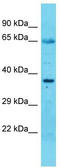RNA Binding Motif Protein 28 antibody, TA343869, Origene, Western Blot image 