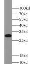 VPS28 Subunit Of ESCRT-I antibody, FNab09434, FineTest, Western Blot image 