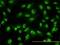 ACD antibody, H00065057-M02, Novus Biologicals, Immunocytochemistry image 