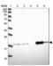 Outer Mitochondrial Membrane Lipid Metabolism Regulator OPA3 antibody, NBP1-92221, Novus Biologicals, Western Blot image 