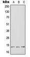 Hes Family BHLH Transcription Factor 2 antibody, GTX55959, GeneTex, Western Blot image 