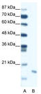 Diablo IAP-Binding Mitochondrial Protein antibody, TA330330, Origene, Western Blot image 