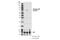 Bruton Tyrosine Kinase antibody, 87141S, Cell Signaling Technology, Western Blot image 