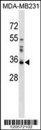 Galectin 8 antibody, 59-575, ProSci, Western Blot image 