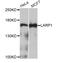 La Ribonucleoprotein Domain Family Member 1 antibody, A4543, ABclonal Technology, Western Blot image 