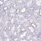 Crystallin Beta B2 antibody, NBP2-13876, Novus Biologicals, Immunohistochemistry frozen image 
