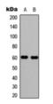 WASP antibody, orb393187, Biorbyt, Western Blot image 
