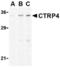 C1q And TNF Related 4 antibody, TA306235, Origene, Western Blot image 