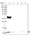 Mitochondrial import inner membrane translocase subunit Tim10 antibody, NBP1-80682, Novus Biologicals, Western Blot image 