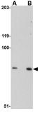 SPG11 Vesicle Trafficking Associated, Spatacsin antibody, GTX31970, GeneTex, Western Blot image 