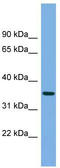 Serine Protease 22 antibody, TA344696, Origene, Western Blot image 