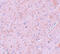 Protein Inhibitor Of Activated STAT 2 antibody, 5743, ProSci Inc, Immunohistochemistry frozen image 