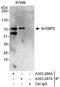 SH3 Domain Binding Protein 2 antibody, A303-287A, Bethyl Labs, Immunoprecipitation image 