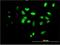 Forkhead box protein F2 antibody, H00002295-M03, Novus Biologicals, Immunocytochemistry image 