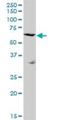 Sushi Repeat Containing Protein X-Linked antibody, H00008406-B01P, Novus Biologicals, Western Blot image 
