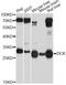Deoxycytidine kinase antibody, A1794, ABclonal Technology, Western Blot image 
