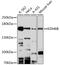 Lysine-specific demethylase 6B antibody, 16-935, ProSci, Western Blot image 