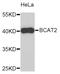 Branched Chain Amino Acid Transaminase 2 antibody, STJ22769, St John