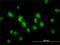 SMAD Family Member 1 antibody, H00004086-M03, Novus Biologicals, Immunofluorescence image 