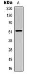 SMAD Family Member 3 antibody, LS-C358329, Lifespan Biosciences, Western Blot image 