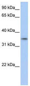 GID Complex Subunit 4 Homolog antibody, TA335480, Origene, Western Blot image 