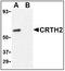 Prostaglandin D2 receptor-like antibody, AP22663PU-N, Origene, Western Blot image 