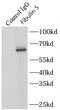 Fibulin 5 antibody, FNab03125, FineTest, Immunoprecipitation image 
