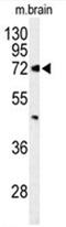 ATP Binding Cassette Subfamily D Member 2 antibody, AP50018PU-N, Origene, Western Blot image 