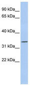Paired Like Homeodomain 1 antibody, TA330257, Origene, Western Blot image 