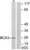 Proline-rich protein BCA3 antibody, LS-C119278, Lifespan Biosciences, Western Blot image 