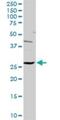 Hydroxypyruvate Isomerase (Putative) antibody, H00081888-D01P, Novus Biologicals, Western Blot image 