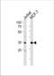 ATF4 antibody, TA324485, Origene, Western Blot image 