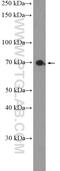 Macrophage Expressed 1 antibody, 23960-1-AP, Proteintech Group, Western Blot image 